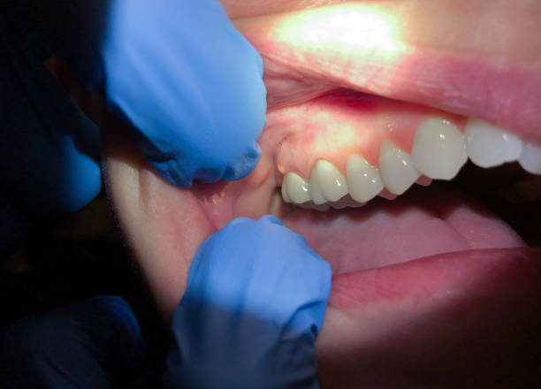 Best Emergency Treatment for Jaw Pain or Injury in Conway, PA