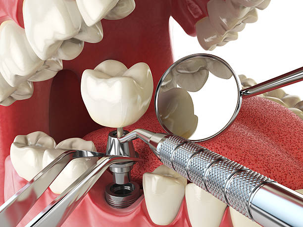 Best Emergency Wisdom Tooth Extraction in Conway, PA